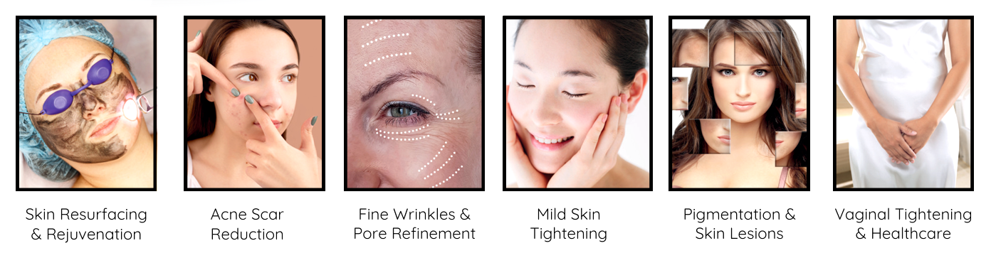 Fungsi Utama Sharga CO2 Fractional Laser